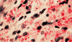 Image: Light micrograph of M. Leprae bacteria (red) in a sample of nasal mucus (Photo courtesy of CNRI).